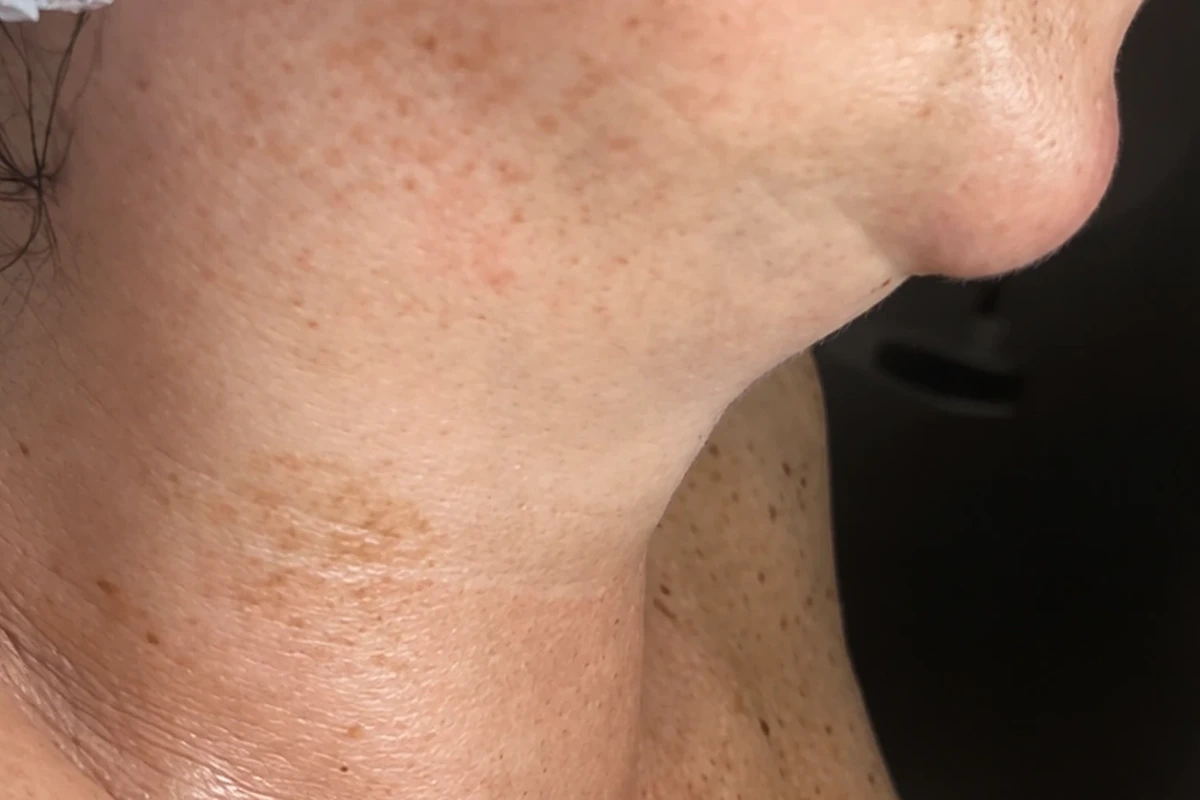 cuello2