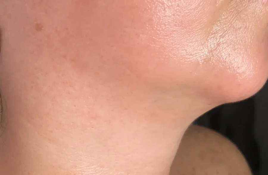 cuello-antes-